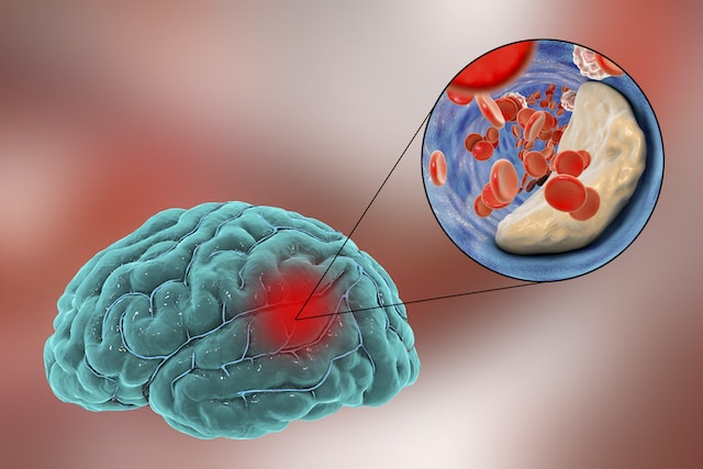 ¿Cómo saber si necesitas un detox cerebral?